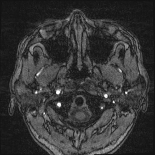 Click on the Serie image to view the images of VILLANUEVA, WILLIAM A.